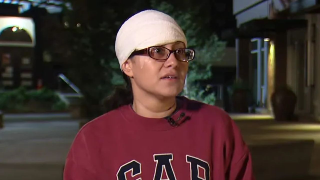 Woman Accused of Horrific Seattle Attack Allegedly Bit Stranger’s Forehead, Leaving Permanent Injuries