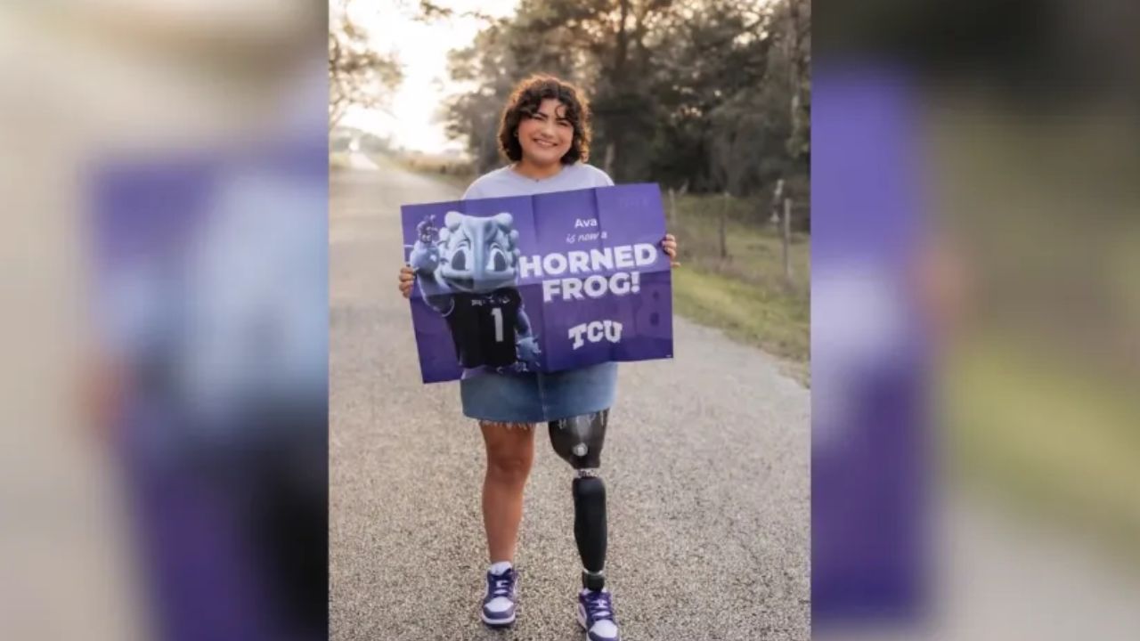 Texas Teen Who Lost Leg to Osteosarcoma Has Big Plans at TCU — Including Helping Children With Cancer